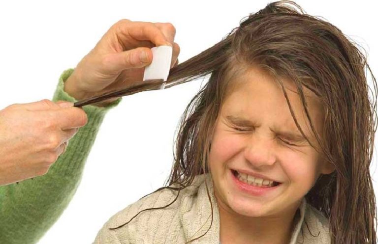 Saç Biti Belirtileri Nedir, Nasıl Tedavi Edilir?