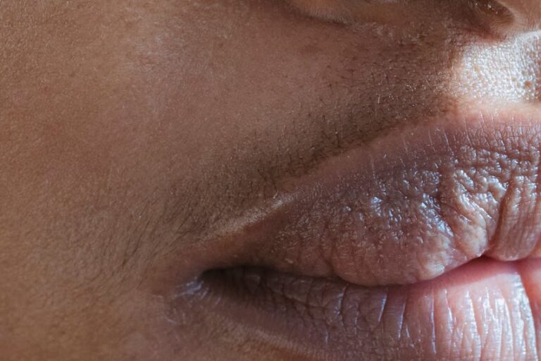 Kadınlarda aşırı tüylenme nedenleri?