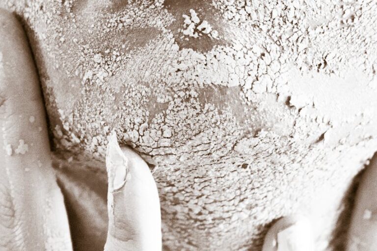 Cilt kuruluğu neden olur? Nasıl önlenir?