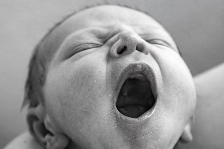 Bebeklerde Pamukçuk