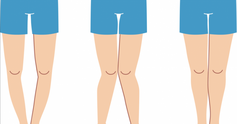 Çocuklarda Raşitizim