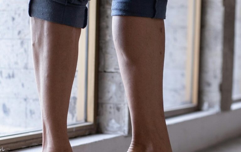 Varis nedir? Belirti ve tedavi yolları nelerdir?