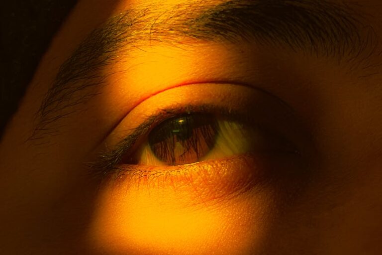 Gözyaşı Kanalı Tıkanıklığı