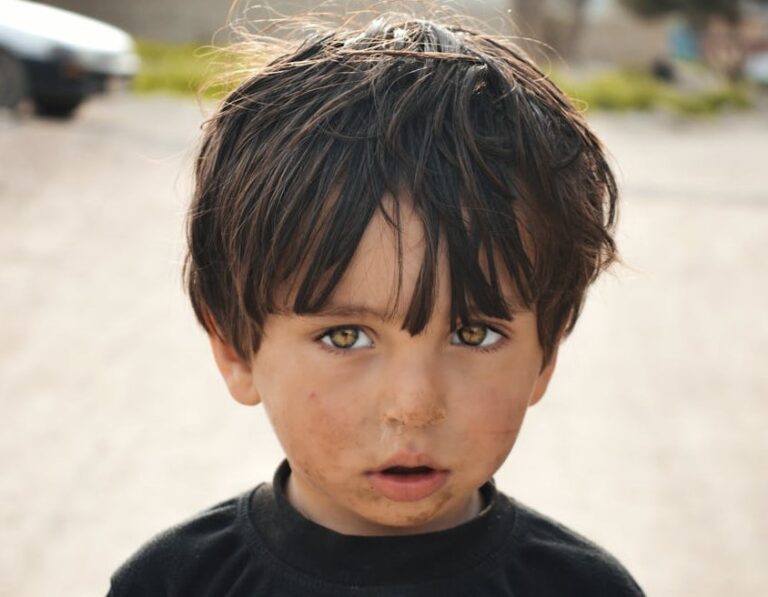 İmpetigo-Cilt İltihabı