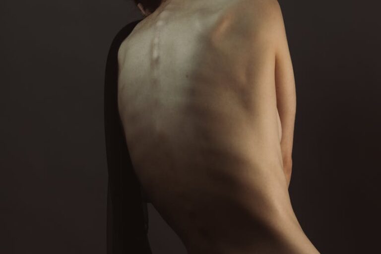 Omurga Eğriliği-Skolyoz