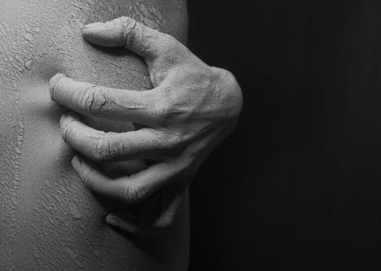 Kurdeşen Belirtileri