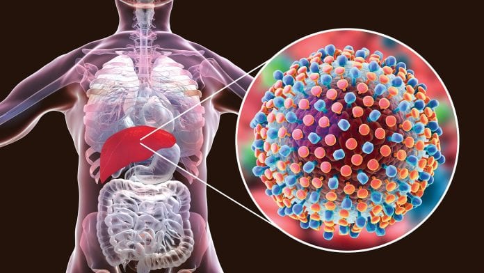 Hepatit C nasıl tedavi edilir?