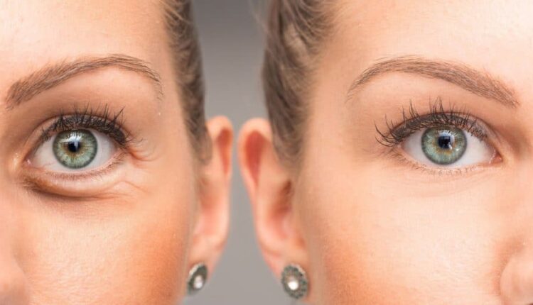 Yorgunluk belirtileri nasıl yok edilir?