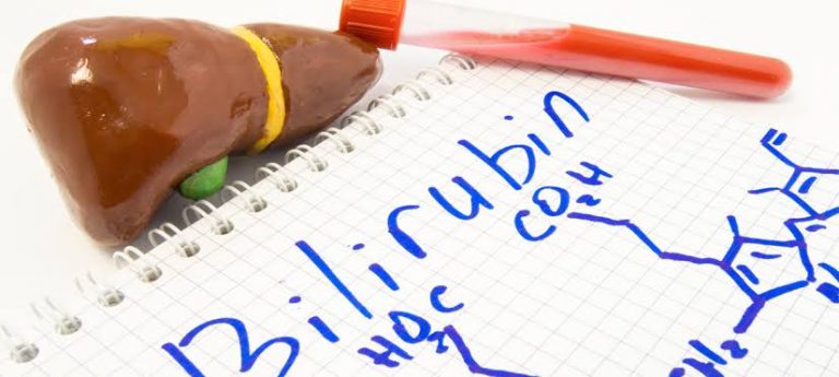 Gilbert Sendromu Nedir?