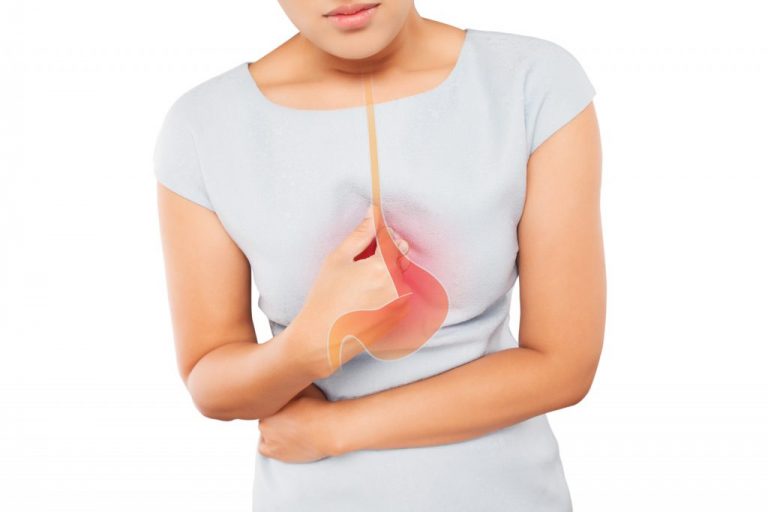 Gastroözofageal Reflü Belirtileri