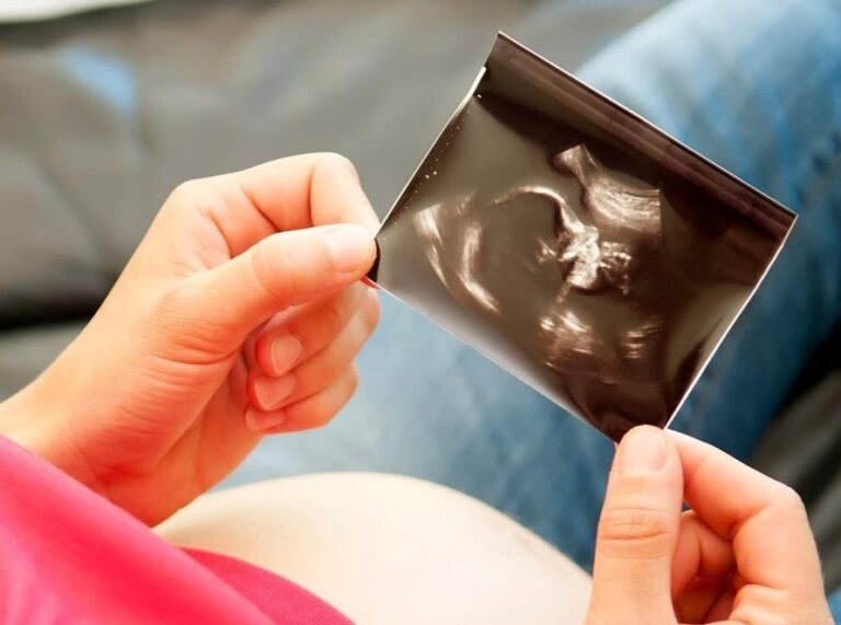 Ramzi Teorisi ve Bebek Cinsiyet Tahmini