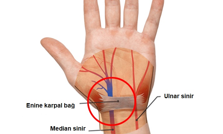 Karpal tünel sendromu nasıl teşhis edilir?