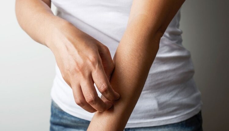 Kuru ciltler için doğal çözümler