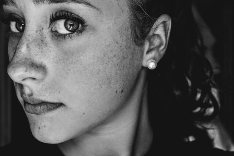 Ciltte Kahverengi Lekeler Neden Olur?