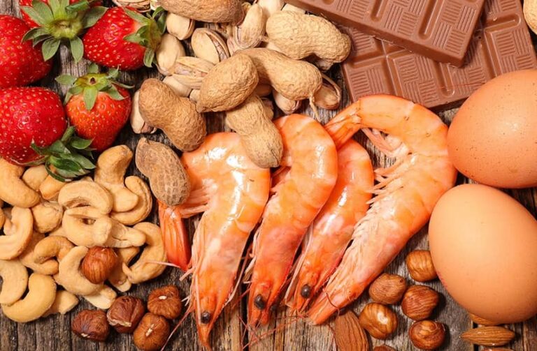 Çocuklarda 5 Yaygın Gıda Alerjisi