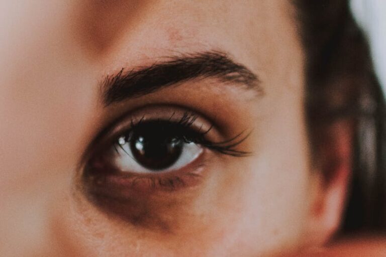 Göz altı morlukları için doğal ve etkili çözümler