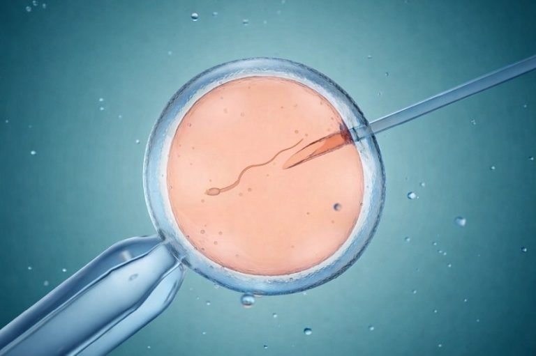 Tüp Bebek Tedavisinde Uygulanan Testler Nelerdir?